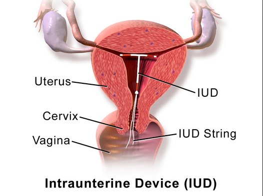 Would you care to stick your nub up here to compete with the IUD that's already in it?